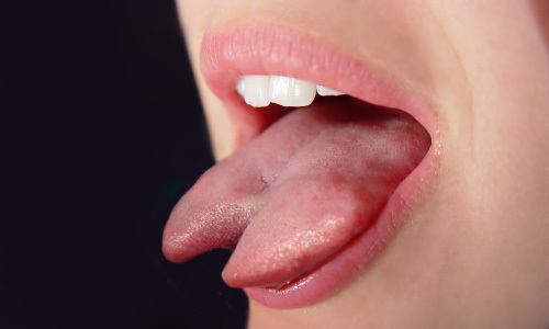 picture Snake Tongue In Human Mouth